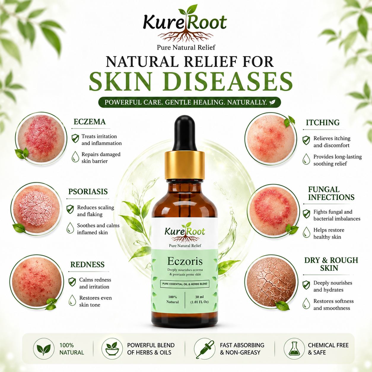 Eczoris Oil - For Eczema, Psoriasis & Skin Allergies