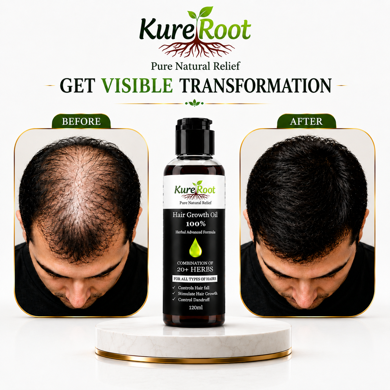 Kure Root Hair Growth Oil - 100% Natural Advance Formula